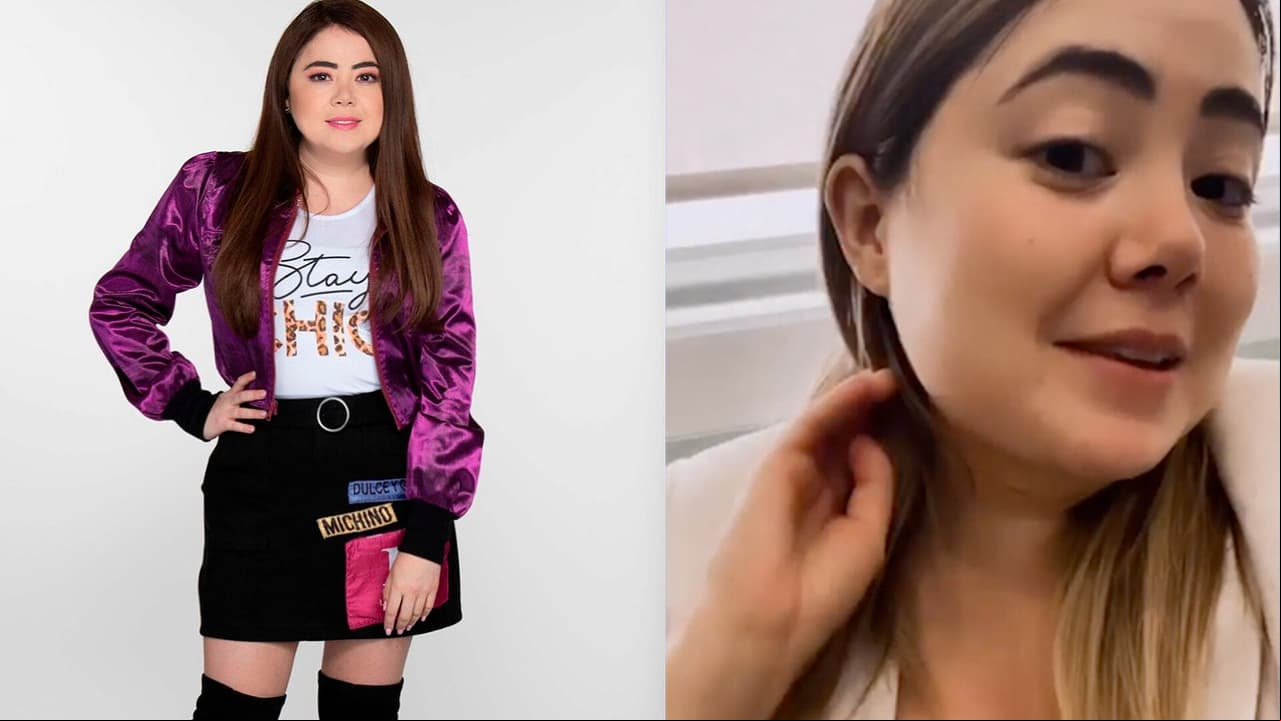 Mariana Botas sorprende al mostrar el antes y después de su bichectomía