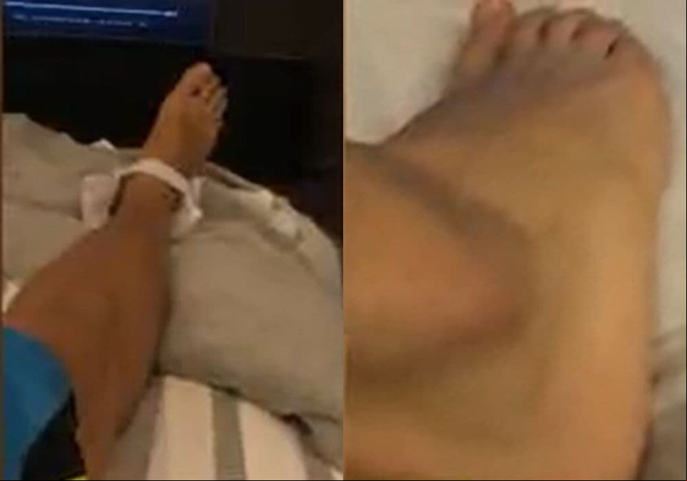 David Zepeda muestra fotos de su accidente