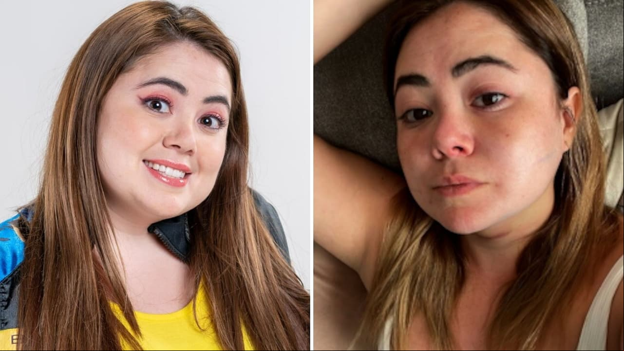 Mariana Botas muestra la cicatriz de su bichectomía y se sincera