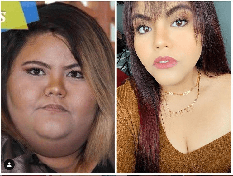 “Más de 80 kilos menos. Mi piel está llena de estrías, cicatrices y demás. Mi piel está suelta, tan suelta que me causa inseguridad. Mi piel es el vivo recordatorio DIARIO de mi pasado, de mi depresión, de mi falta de autoestima y amor propio. Sin embargo, mi piel soy Yo. Cuento mi historia, mis mayores miedos y mis inseguridades”, señaló la joven.