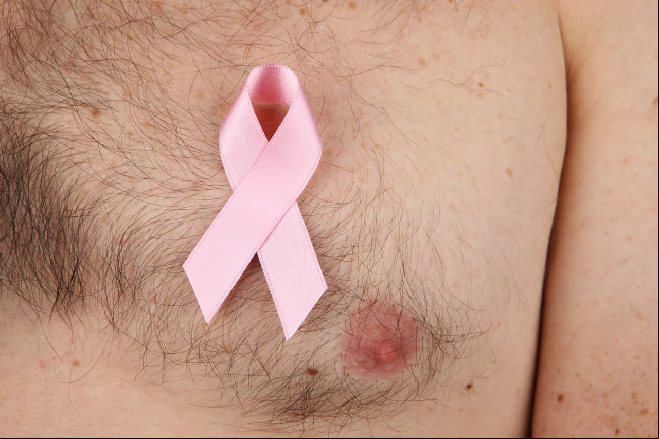 ¿Sabías que los hombres también sufren cáncer de mama?