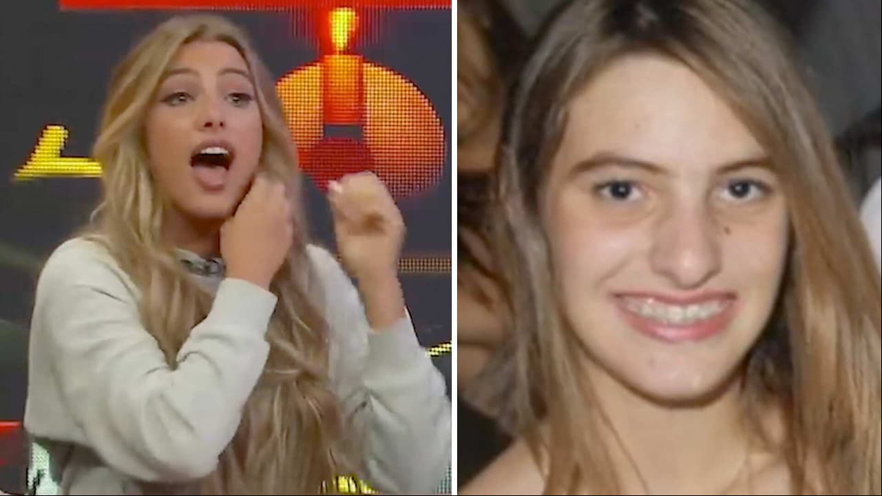 Lele Pons reacciona al verse antes de sus arreglos estéticos