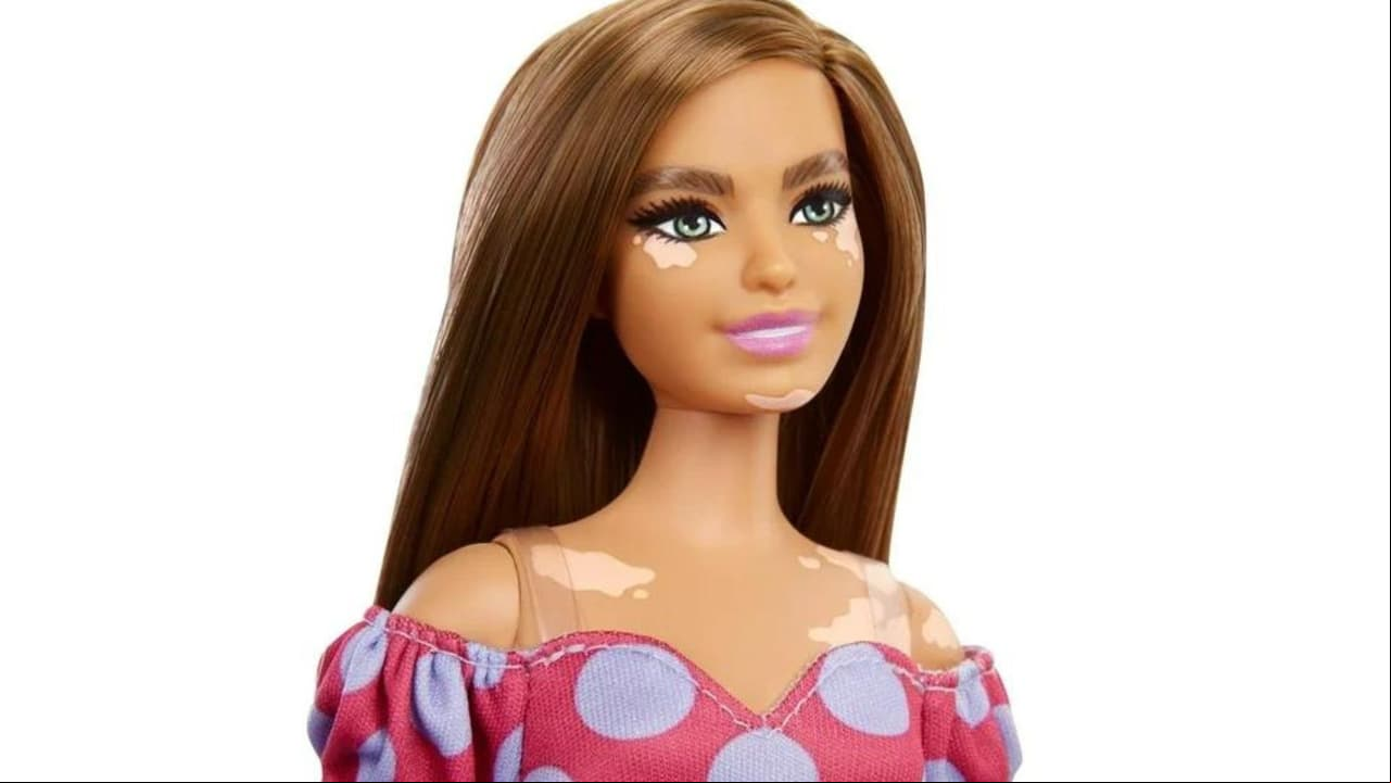 Barbie con vitiligo