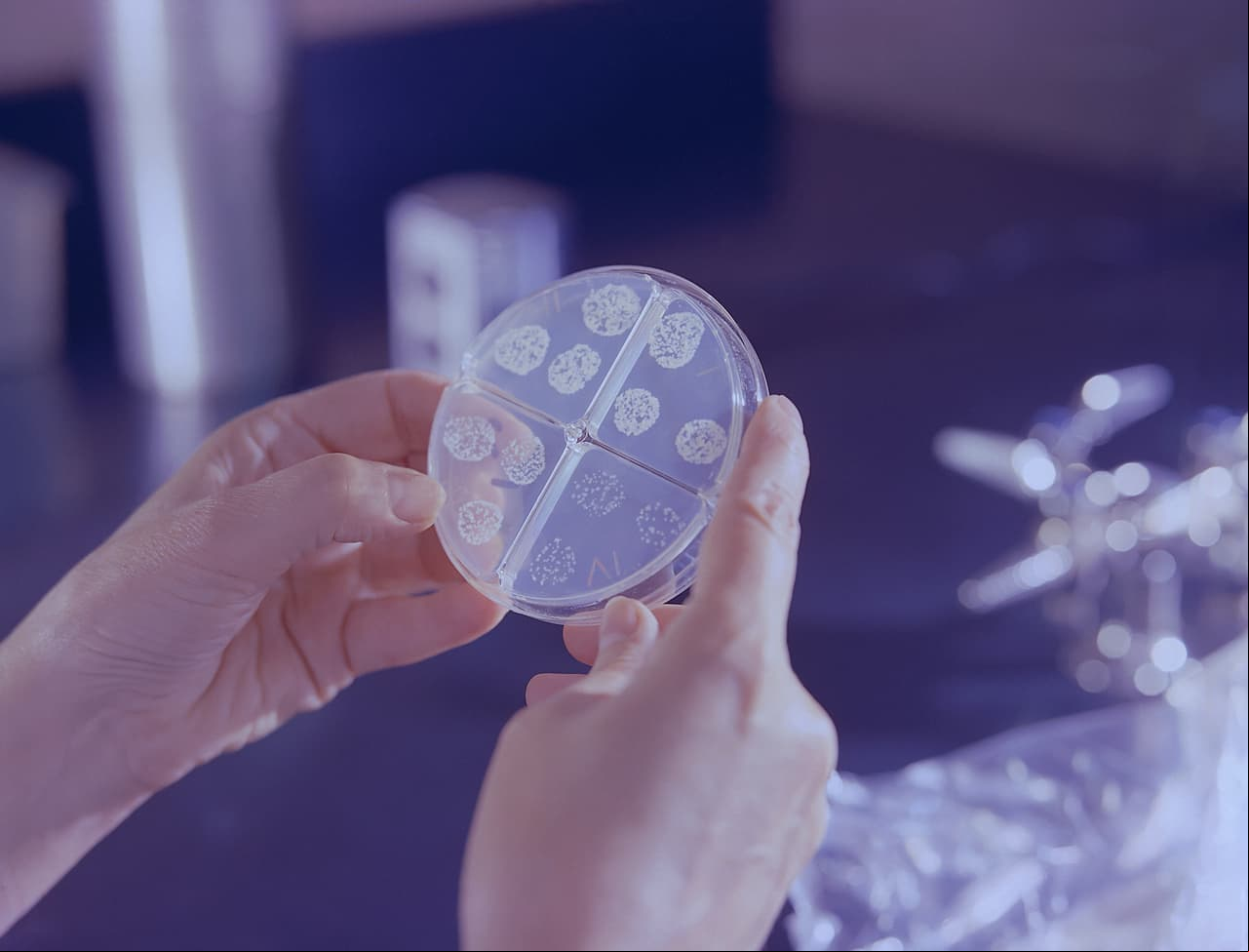 Científicos descubren bacteria